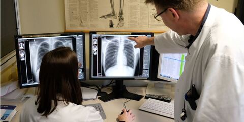 Zwei Ärzte begutachten ein Röntgenbild der Lunge